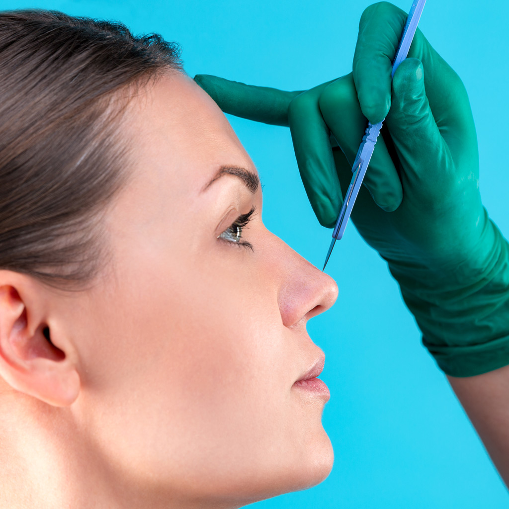 Rinoplasti (Burun Ameliyatları)